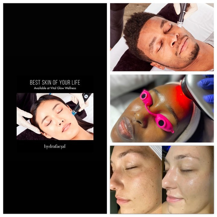 Collage of skin treatments in progress and resulting skin